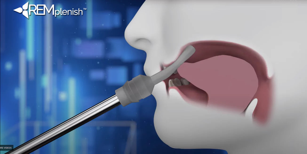 Troubleshooting Made Easy: Common Issues Resolved with the REMplenish Myo-Nozzle